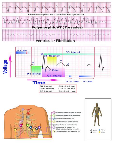 Ekg Practice Worksheets With Answers
