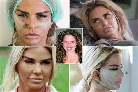 Katie Prices Plastic Surgery Transformation Over The Last 25 Years After Finding Fame Aged 17