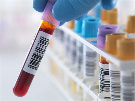 What Is Mch In A Blood Test