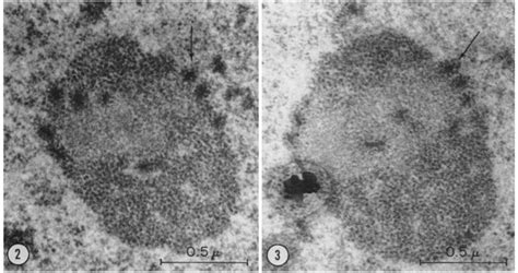 Electron Micrograph Of The Same Nucleolus As Shown In Figs 1 And 2