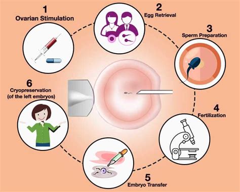 What Is Icsi A Detailed Guide To Intracytoplasmic Sperm Injection By