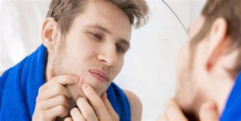 Pin On Dermatologist Expert Tips