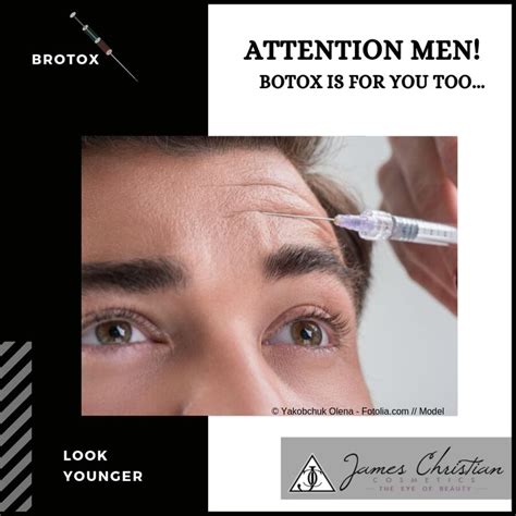 Botox Isnt Just For Women Guys Brotox Is Here And Popularity Is Soaring In Our Offices