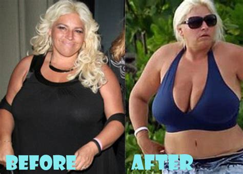 beth chapman plastic surgery before and after pictures lovely surgery celebrity before and