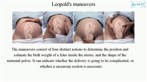 Leopolds Maneuvers Youtube