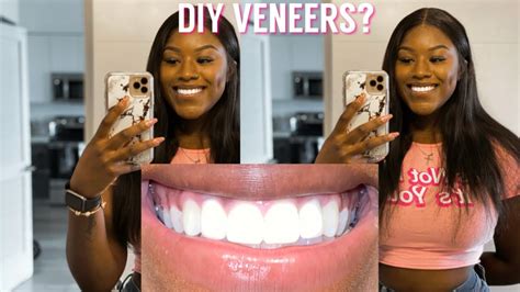 Diy Veneers Perfect Teeth Hack Skai Beauty Youtube