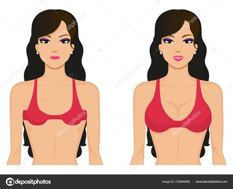 Vector Illustration Breasts Before And After Stock Vector Image By