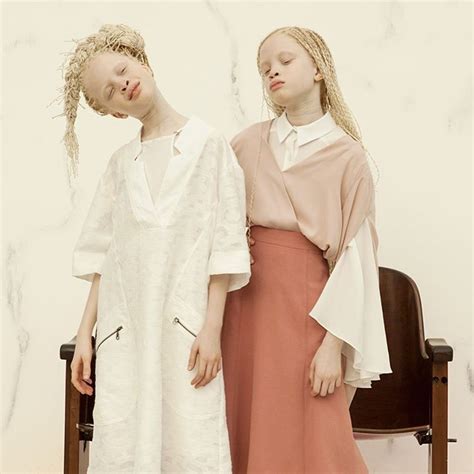 11 Year Old Twins Taking Fashion World By Storm As Models With Albinism