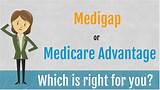 Pictures of Difference Between Advantage Plans And Medicare Supplements
