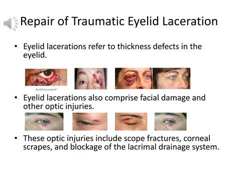 Solution Repair Of Traumatic Eyelid Laceration Studypool