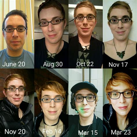 My Timeline Day 1 Of Hrt To 9 Months How Am I Doing Rtranstimelines