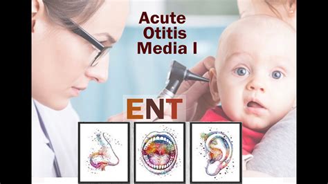 Ent Ear Acute Otitis Media I Youtube