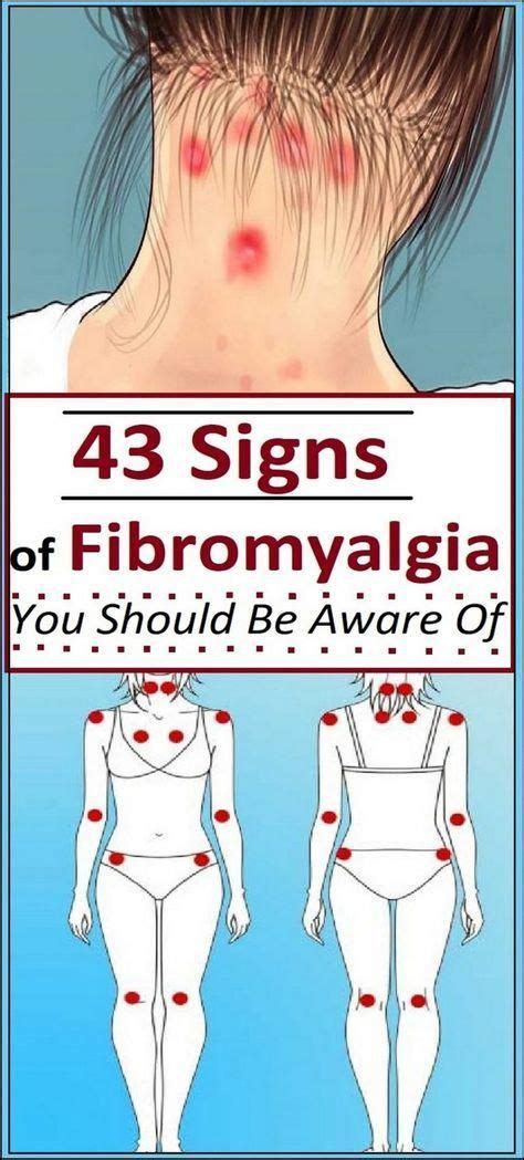 43 Signs Of Fibromyalgia You Should Be Aware Of Insta Healthy Diet