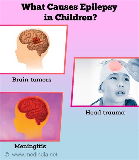 What Are The Causes Triggers Complications And Types Of Epilepsy In