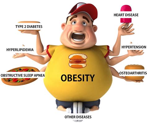 Obesity Is A Disease Akshay