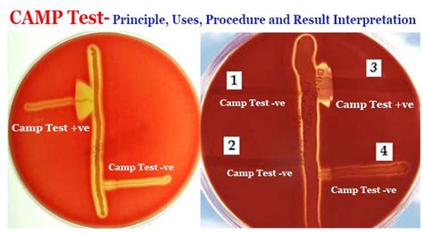 Camp Test Principle Uses Procedure And Result Interpretation
