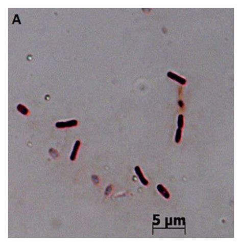 Morphology Of Bacillus Subtilis Strain B37 A Rod Shaped Cells Of