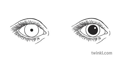 Two Eyes Different Size Pupils Black And White Illustration Twinkl