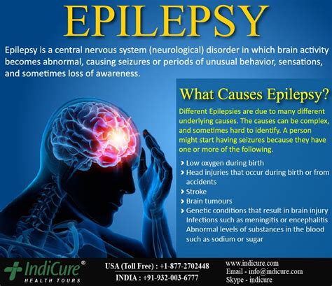 Epilepsy Varies Greatly And Affects Everyone Differently If You Or Someone You Know Has