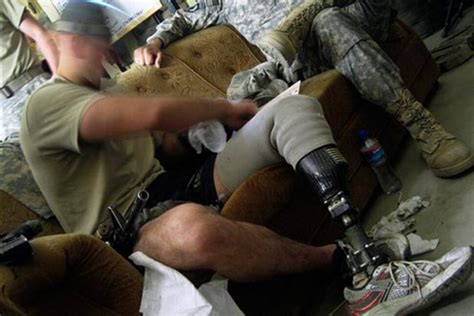 New Prosthetics Keep Amputee Soldiers On Active Duty Us News