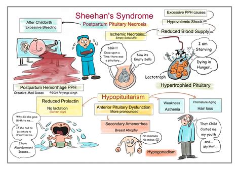 Sheehans Syndrome Postpartum Hypopituitarism Creative Med Doses