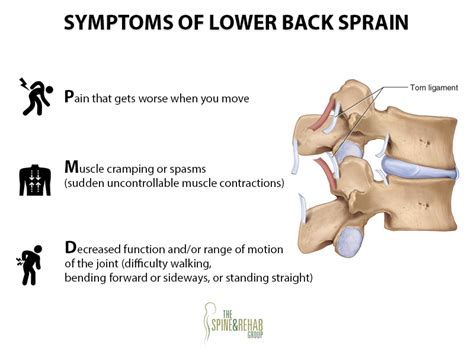 Lower Back Ligaments