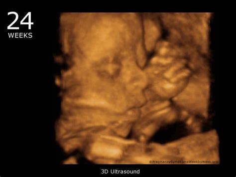 3d Ultrasound At 24 Weeks Pregnant During The 24th Week Of Pregnancy