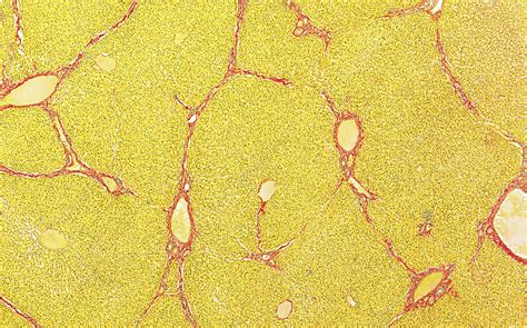 Liver Lobules Light Micrograph Stock Image C0526784 Science