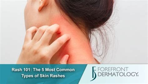 Rash 101 The 5 Most Common Types Of Skin Rashes Forefront Dermatology