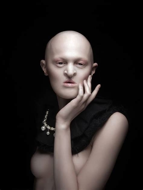 Meet Melanie Gaydos 28 Year Old Model With A Rare Genetic Disorder Who Broke All Fashion