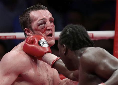 Denis Lebedev Eye Injury Boxers Face Extremely Swollen In Fight With