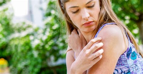 Itchy Skin No Rash Causes Symptoms And Treatments
