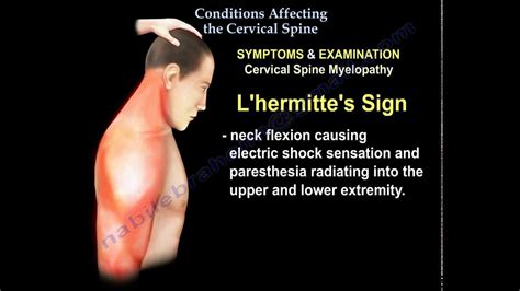 Conditions Affecting The Cervical Spine Everything You Need To Know