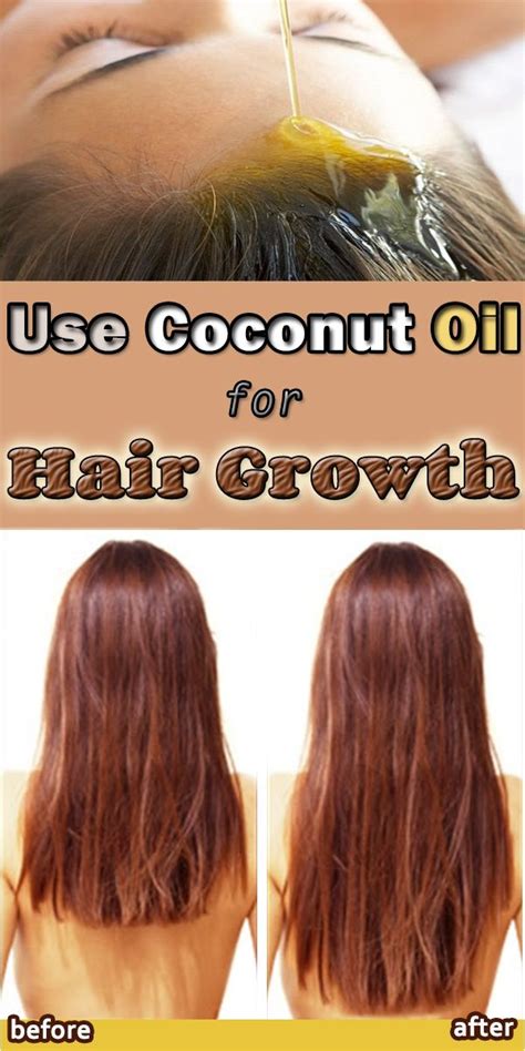 Coconut oil can penetrate into the hair better than other oils, allowing it to moisturize dry hair faster, making it softer, shinier, and in better condition. Use Coconut Oil for Hair Growth | Coconut oil hair growth ...