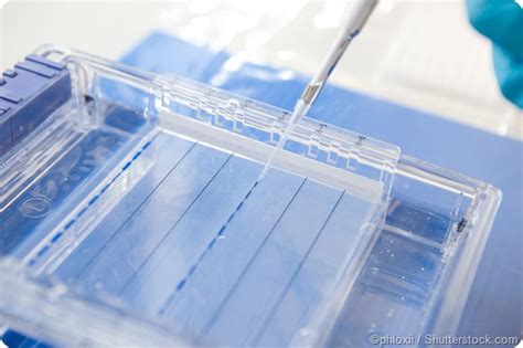 What Is Polyacrylamide Gel Electrophoresis Page