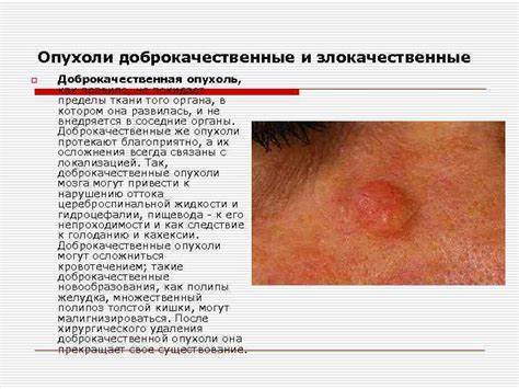 Опухолевый рост Выполнила студентка 270 гр Конарева Д Картинка - Опухолевый рост Выполнила студентка 270 гр Конарева Д