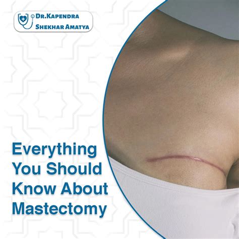 Everything You Should Know About Mastectomy