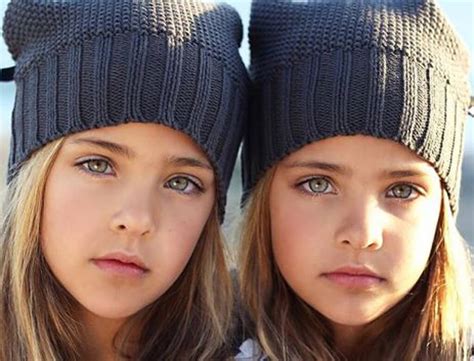 Most Beautiful Twins In The World Birth To 2022 History All Day