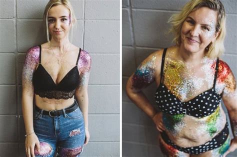 Women Celebrate Scars And Imperfections With Body Positive Shoot Daily Star