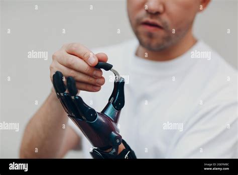 Young Disabled Man With Artificial Prosthetic Hand Put On Finger Nozzle