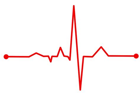 It gives data about your pulse (heart rate) and rhythm and depicts if. ECG signals (744 fragments) | IEEE DataPort