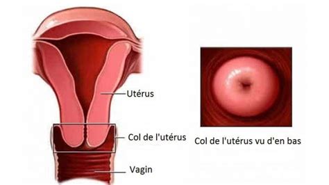 Douleurs Au Fond Du Vagin