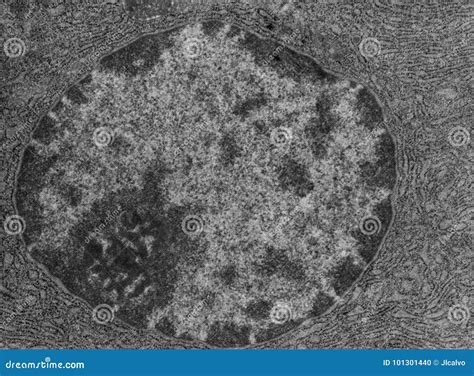 Nucleus And Nucleolus Tem Stock Photo Image Of Cytology 101301440