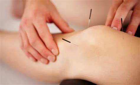 Orthopedic Acupuncture In Brooklyn NY Pulse Acupuncture