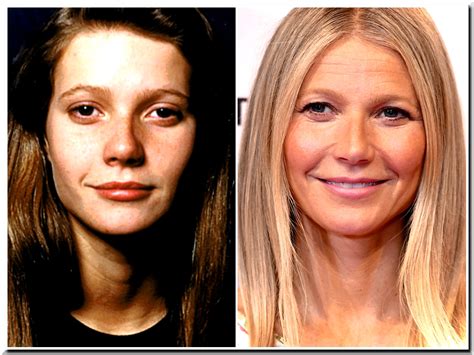 Gwyneth Paltrow Open Up Her Botox Injection But Hide Other Surgeries