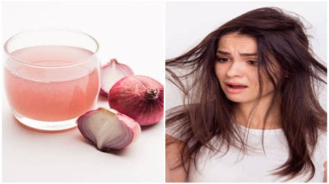 Top 156 Garlic Benefits For Hair In Tamil Polarrunningexpeditions