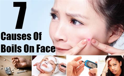 Top 7 Causes Of Boils On Face Main Reasons For Boils On Face