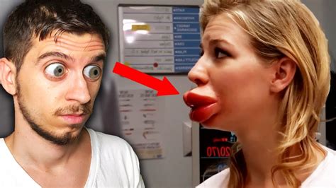 Kylie Jenner Lips Gone Wrong Youtube