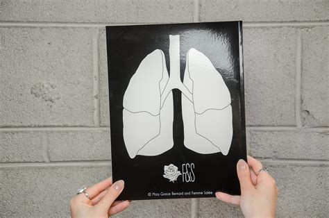 Cystic Fibrosis Coloring Book Mary Grace Mg Bernard