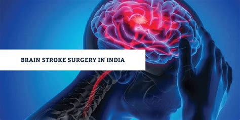 Brain Stroke Surgery In India